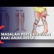 Video Cara Mencegah Kelainan Bentuk Kaki Bayi dan Anak-anak 2021