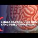 Video Pahami Gejala, Penyebab Hingga Cara Mencegah Radang Usus Buntu 2021 Video Pahami Gejala, Penyebab Hingga Cara Mencegah Radang Usus Buntu 2021