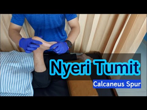 Video Cara mengatasi nyeri tumit saat bangun tidur pagi 2021