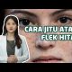 Video CARA MENGHILANGKAN FLEK HITAM SECARA ALAMI DENGAN CEPAT 2021