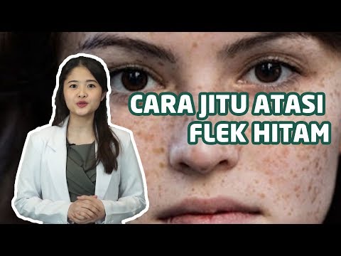 Video CARA MENGHILANGKAN FLEK HITAM SECARA ALAMI DENGAN CEPAT 2021