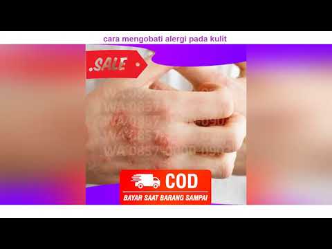 Video WA 0857-0000-0903 cara mengobati alergi pada kulit 2021