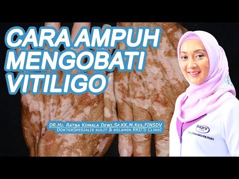 Video Cara Ampuh Mengobati Vitiligo 2021