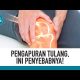 Video Penyebab dan Cara Menghindari Pengapuran Tulang | lifestyleOne 2021