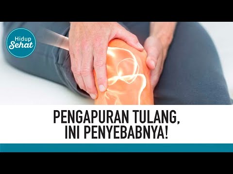 Video Penyebab dan Cara Menghindari Pengapuran Tulang | lifestyleOne 2021
