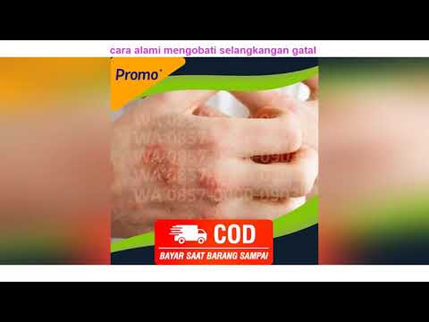 Video WA 0857-0000-0903 cara alami mengobati selangkangan gatal 2021