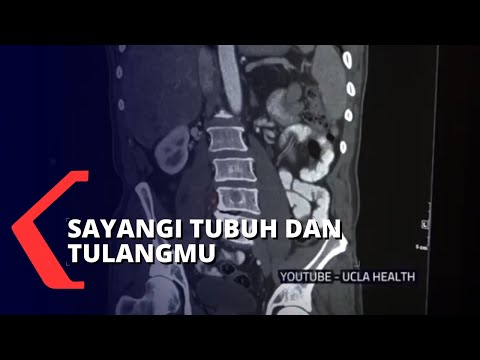 Video Penyebab dan Cara Mencegah Kanker Tulang pada Manusia 2021