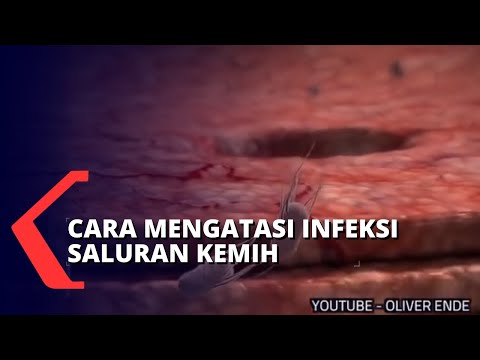 Hati-hati dengan Infeksi Saluran Kemih! 2021