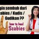 Cara mengobati Scabies / Kudis / Gudikan // How to heal Scabies 2021