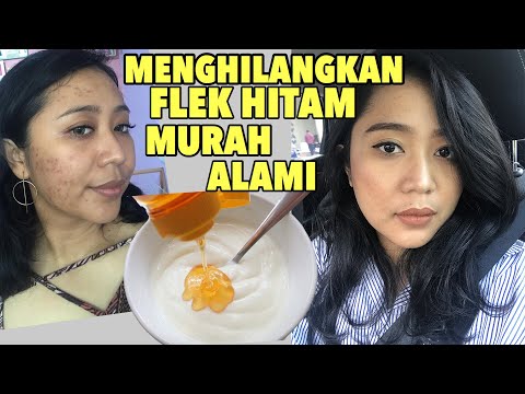 CARA MENGHILANGKAN FLEK HITAM DI WAJAH SECARA MUDAH, MURAH, CEPAT DAN ALAMI (ANTI RIBET) 2021