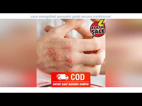 WA 0857-0000-0903 cara mengobati penyakit gatal secara tradisional 2021