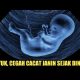 Cara Mencegah Cacat Janin Yang Perlu Ibu Hamil Lakukan 2021 Cara Mencegah Cacat Janin Yang Perlu Ibu Hamil Lakukan 2021
