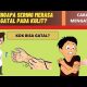 Penyebab Gatal Terus Menerus di Kulit dan Cara Mengatasinya 2021 Penyebab Gatal Terus Menerus di Kulit dan Cara Mengatasinya 2021